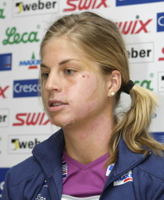 LANG VEI TILBAKE: OL var det siste Astrid Uhrenholdt Jacobsen tenkte p� da hun m�tte pressen i august, en stund etter at hun hadde skadet seg stygt p� sykkelen. 
Foto: Terje Bendiksby / SCANPIX .