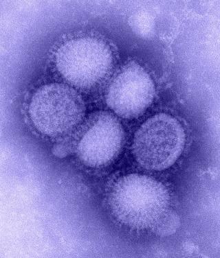 HER HAR DET SKJEDD EN STOR MUTASJON: Det er s�rlig n�r virus fra ulike dyrearter infiserer samme individ vi f�r de store mutasjonene som gir opphav til nye virus som folk ikke har beskyttelse imot. Foto: WIKIMEDIA/CDC