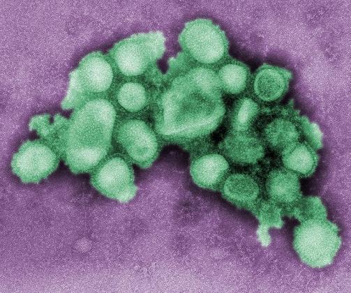 H1N1 2009: Svineinfluensaen som rammer oss n� har genmateriale fra fugl, gris og mennesker. Foto: CDC/WIKIMEDIA