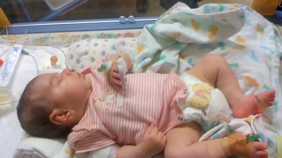 NEKTET � GI OPP: Det nyf�dte barnet, kjent som �baby z�, ble f�dt i Australia med en sjelden uhelbredelig sykdom som heter MoCD (molybden cofactor deficiency), som gj�r at giftig sulfitt produseres i kroppen. Sykdommen f�rer til store hjernskader, og de fleste d�r bare noen m�neder etter f�dselen. �Baby z� hadde harde kramper etter bare noen dager. P� tross av dette nektet foreldrene til �baby z� � gi opp. Foto: SCANPIX