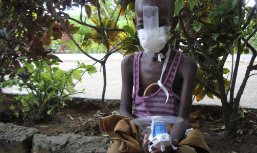 HARDT SKADET: Ahmed Mohamed Mohamoud holder motet oppe ved � leke med leke-helikopteret sitt. Foto: AP Photo/Farah Abdi Warsameh/Scanpix