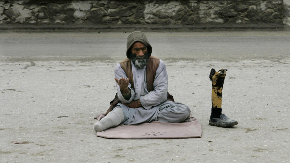  OFFER:  En mann i Kabul, som har blitt offer for en av flere millioner landminer i Afghanistan etter flere ti�r med krig i landet. Foto: RAFIQ MAQBOOL, AP/SCANPIX.