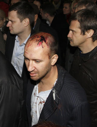 87 SKADDE: En skadd mann ankommet Moskovsky togstasjon i St. Petersburg etter ulykken. Foto:  REUTERS/Alexander Demianchuk/Scanpix