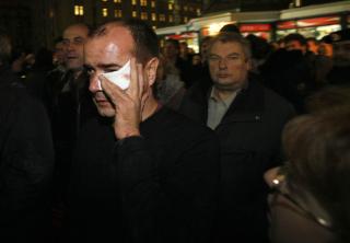  SKADD:  En av de skadde passasjerene med hurtigtoget Nevskij Express framme p� Moskovskij-stasjonen i St. Petersburg i natt. Foto: DMITRIJ LOVETSKIJ, AP/SCANPIX.