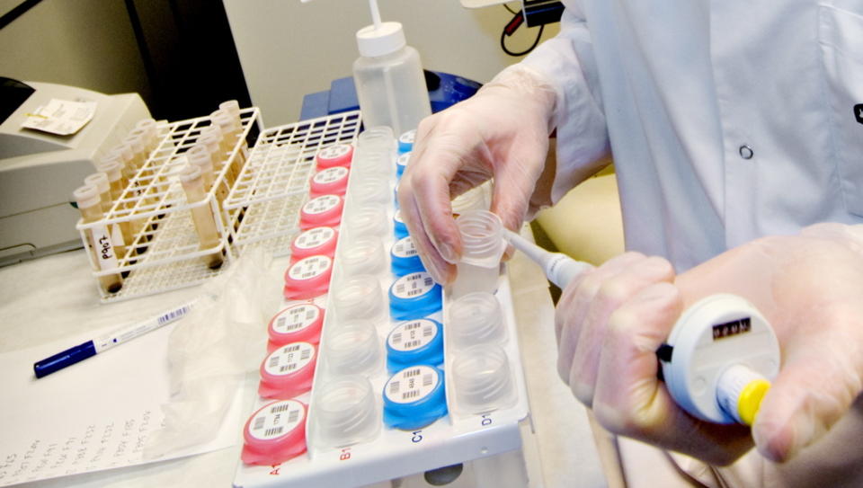SKAL TESTE: Opptil 1000 lungekreftsyke i �ret skal trolig testes for om de har effekt av den nye medisinen mot lungekreft. Dette bildet er tatt p� laboratoriet for gentesting ved Ullev�l universitetssykehus. Foto: John T. Pedersen/Dagbladet