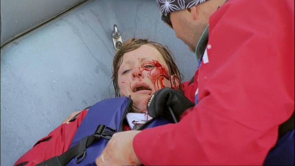 MYE BLOD: Anniken Sand hylte og gr�t da hun fikk et kraftig slag av en bom p� A-jolla hun skulle man�vrere i finalen. Foto: TVNORGE