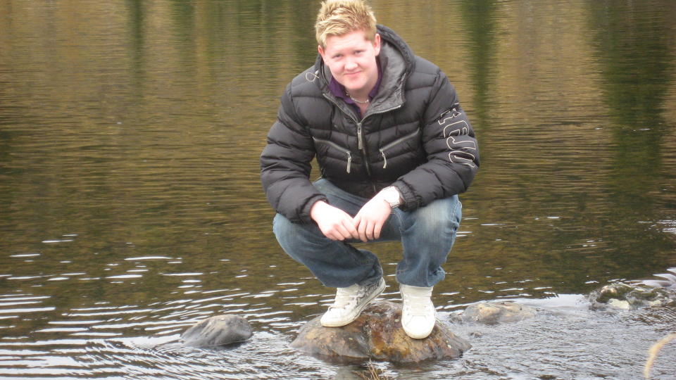 LEGETABBE KAN KOSTE LIVET: Mathias Wilberg (17) har idag ingen svulster i kroppen, men b�de han og familien er redd for at kreften kan komme tilbake. Da 17-�ringen fikk fjernet en f�flekk i 2006 kastet legen den i s�pla uten videre unders�kelser. Tre �r senere har kreften f�tt spredd seg, og idag har han bare 45 prosent sjanse for � bli frisk. Foto: Privat