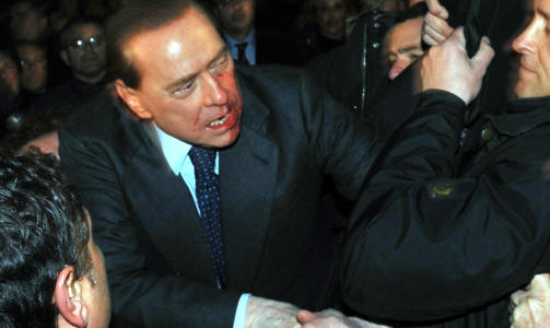 IKKE ALVORLIG SKADD: Berlusconi tok seg tid til � ta farvel med tilskuerne f�r han ble fraktet til sykehuset etter slaget. Statuen han ble sl�tt med var laget av metall eller marmor og han ble p�f�rt et nesebrudd og fikk �delagt to tenner. Foto: REUTERS/SCANPIX