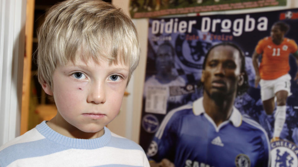 FIKK EGGBASERT VAKSINE: Foreldrene til Jacob (7) har flere ganger takket nei til skolens tilbud om svineinfluensavaksine. Han ble likevel vaksinert med Pandemrix av Ullev�l sykehus, uten at foreldrene fikk vite om det. Foto: HANS ARNE VEDLOGG