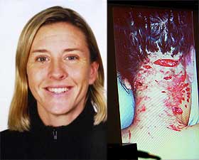 SJANSEL�S: Diana Whipple (33) d�de 26. januar i fjor av skadene etter at hundene angrep henne. 