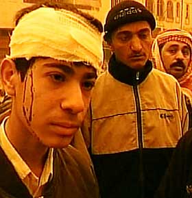 SIVILE OFRE: En av bagdadborgerne som ble s�ret da en rakett traff bydelen al-Shaab i g�r. USA antyder at raketten kan ha v�rt irakisk., men utelukker ikke et amerikansk v�pen p� avveie.