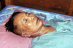 D�DE TIL SLUTT: Pol Pot ble aldri stilt til ansvar for sine forbrytelser mot menneskeheten. Her ligger han i kista si i en landsby p� grensa mot Thailand 16. april 1998.