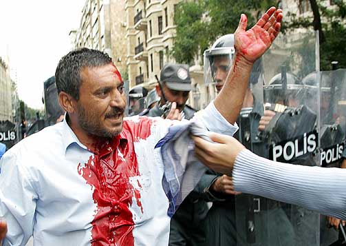 BAKU OKTOBER I �R: En av flere hundre skadde demonstranter i Baku i oktober.
