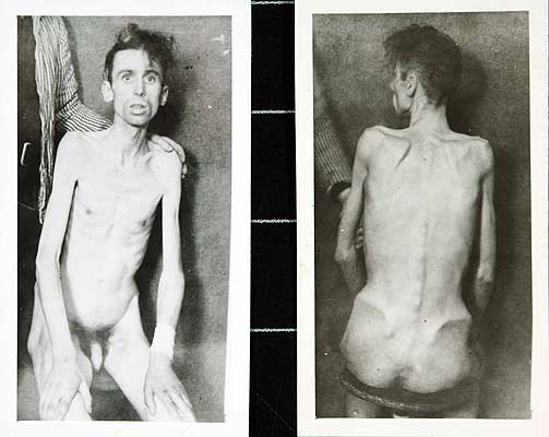 HEINTZ BEIDERMANN (20): Ble torturert og truet med henrettelse av britene i Bad Nenndorf i 1947.