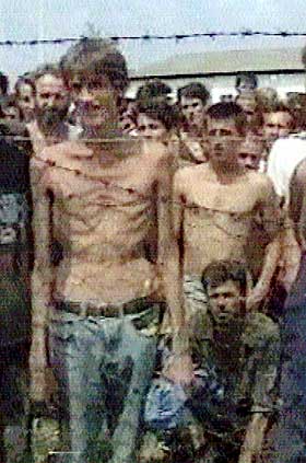OVER 100 000 D�DE: Krigen i Bosnia fikk katastrofale f�lger. Bildet viser fanger i det serbisk-kontrollerte Nordvest-Bosnia sommeren 1992. Over 2 millioner mennesker ble fordrevet.