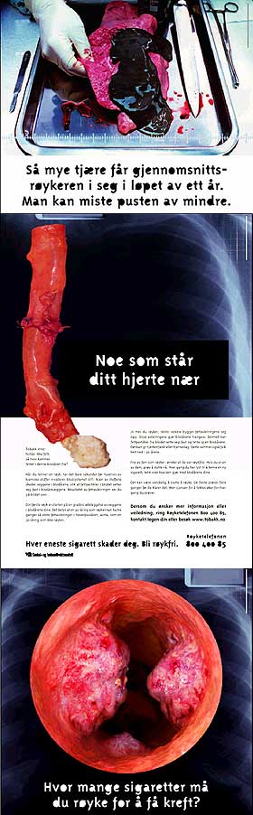 STERKE VIRKEMIDLER: Sosial- og helsedirektoratets antir�ykekampanje �Hver eneste sigarett skader deg� fra 2003 var sv�rt omstridt p� grunn av de sterke virkemidlene.