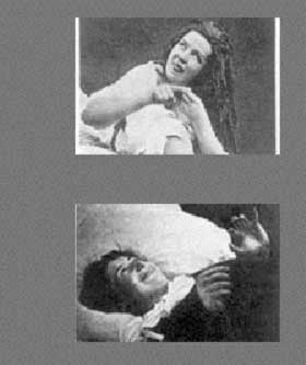 CHARCOTS EGNE PASIENTER: Kvinner med diagnosen �Hysterie�.