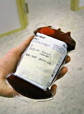 BLODIG ALVOR: Sch�feren Yannick har gitt 500 milliliter av seg selv, til disposisjon for sin lille, syke artsfrende.