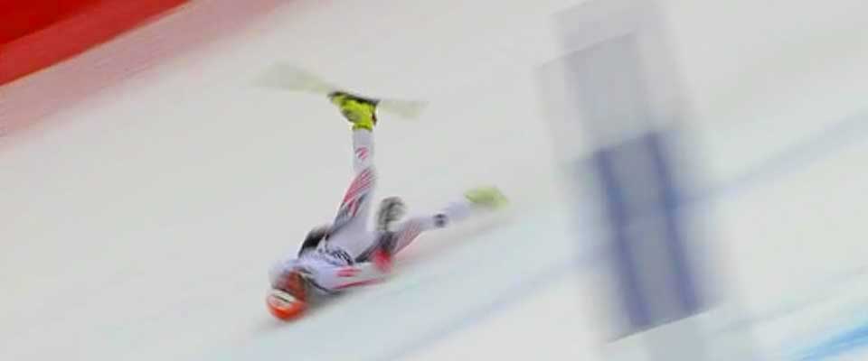 MISTER BEINET: Matthias Lanzinger �dela leggen helt i fallet. Han p�dro seg flere brudd og blod�rene ble ogs� revet av. Derfor klarte ikke legene redde leggen hans.