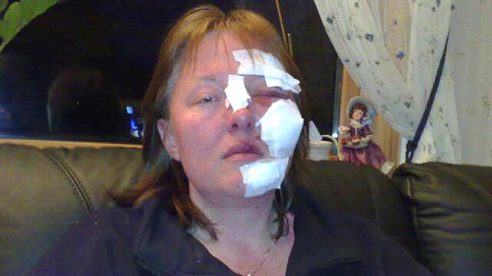 BLE IKKE TRODD: - Jeg forklarte hva som hadde skjedd, men ambulansepersonellet trodde ikke p� meg, sier Marianne Herfindal Johannesen.