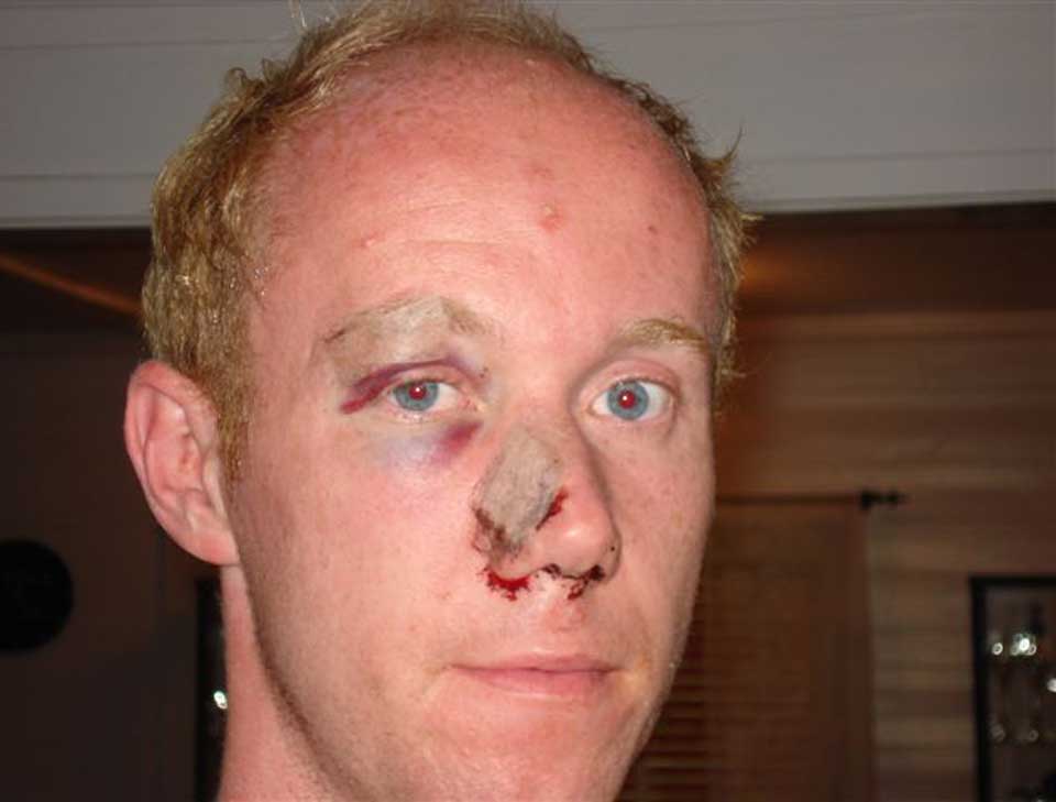 BRUDDSKADER: Natt til s�ndag ble Knut-�yvind Hagen (25) banket opp, trolig fordi han er homofil.