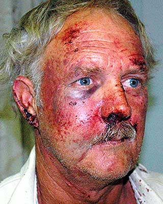 BRUTALT: Bonden William Rogers ble tidligere i �r angrepet og banket opp i samme omr�de som Freeth ble kidnappet fra i g�r.